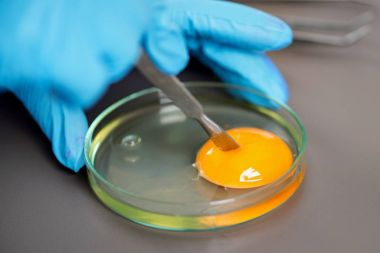 人萊姆IgG(Lyme-IgG)ELISA Kit試劑盒/測試盒 人萊姆IgG(Lyme-IgG)ELISA Kit試劑盒/測試盒