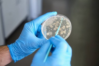 人抗心磷脂抗體IgG(ACA-IgG)ELISA Kit試劑盒/測試盒 人抗心磷脂抗體IgG(ACA-IgG)ELISA Kit試劑盒/測試盒