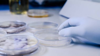 人抗增殖細胞核抗原抗體(PCNA)ELISA Kit試劑盒/測試盒 人抗增殖細胞核抗原抗體(PCNA)ELISA Kit試劑盒/測試盒
