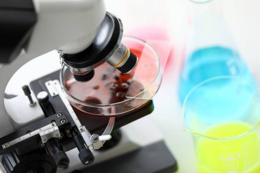 人同型半胱氨酸檢測試劑盒圖3 人同型半胱氨酸檢測試劑盒圖3
