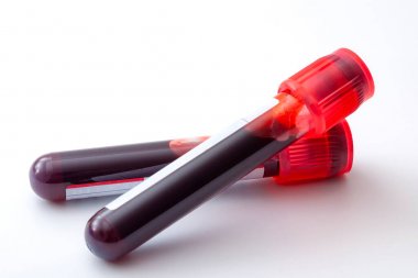 苯胺-4羥化酶活性檢測(cè)試劑盒 苯胺-4羥化酶活性檢測(cè)試劑盒