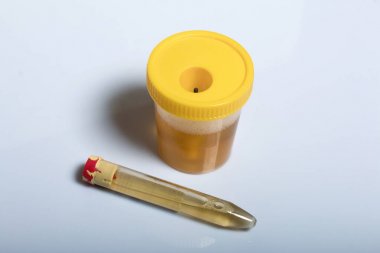 受體TNFRSF結合絲氨酸蘇氨酸激酶2(RIPK2)elisa試劑盒 受體TNFRSF結合絲氨酸蘇氨酸激酶2(RIPK2)elisa試劑盒