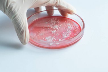 小鼠8-氧鳥嘌呤脫氧核苷(8-oxo-dG)elisa試劑盒 小鼠8-氧鳥嘌呤脫氧核苷(8-oxo-dG)elisa試劑盒